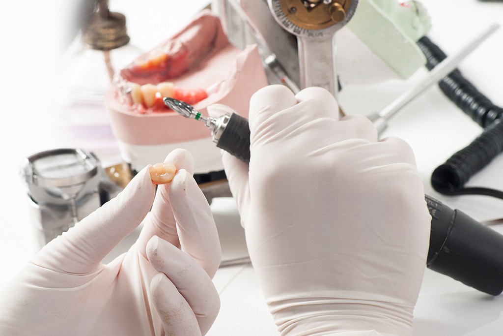 ODs Dental Laboratory Tustin, CA Dental Prosthetics ODs Dental Lab