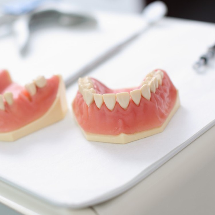 ODs Dental Laboratory- Tustin, CA- Denture Accessories