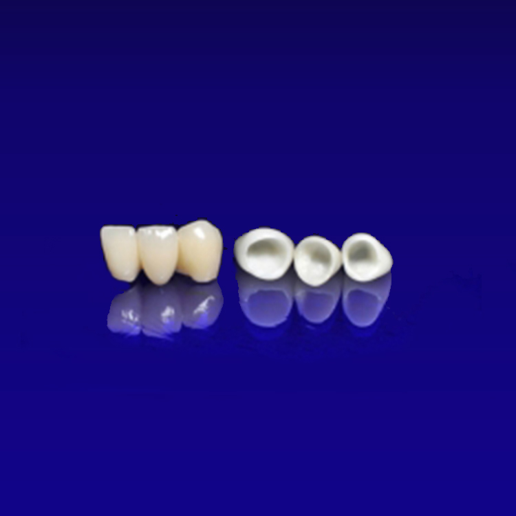 ODs Dental Laboratory- Tustin, CA- Metal-Free Dental Crowns