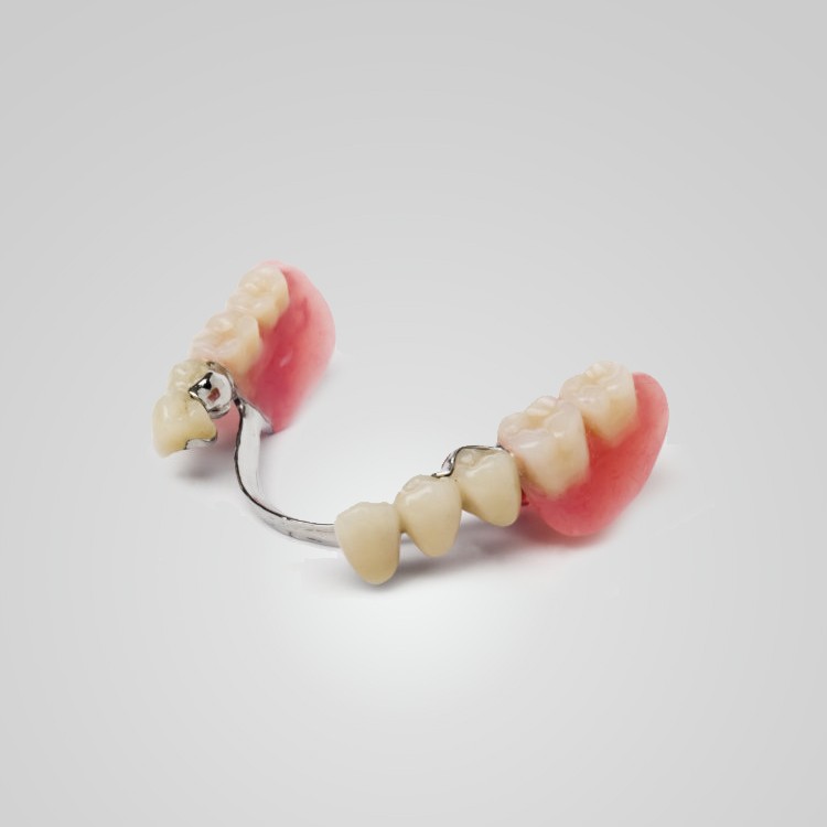 ODs Dental Laboratory- Partial Dentures- Tustin, CA