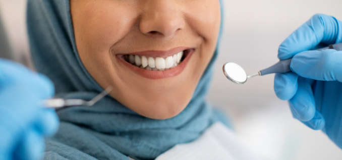 Veneers