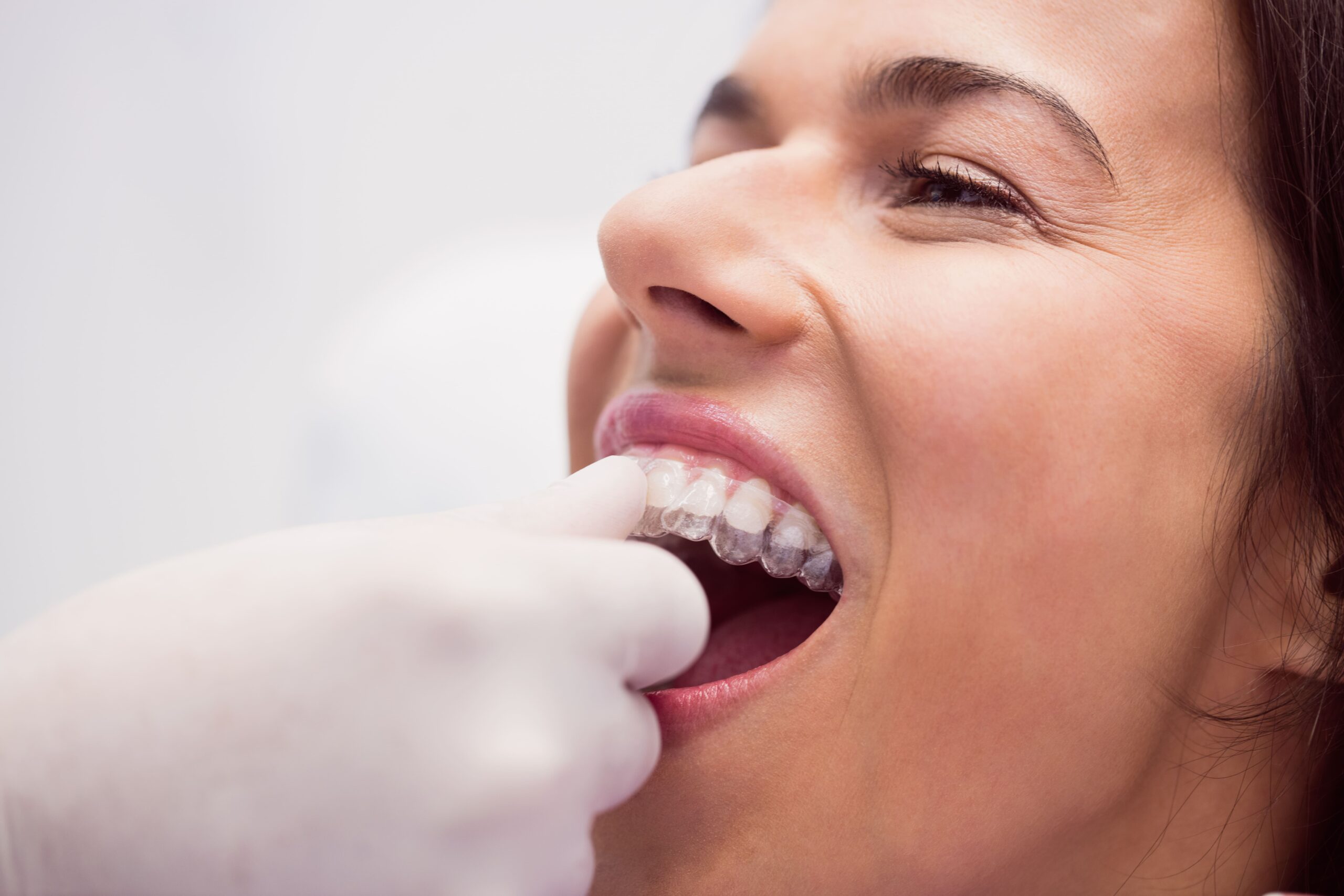 night guard for teeth